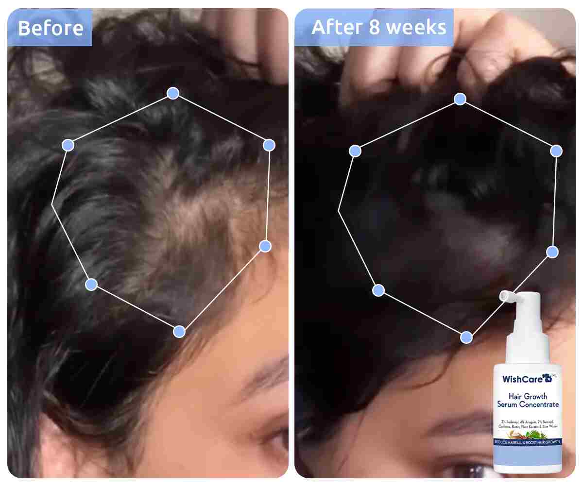 WishCare hair growth serum - 2